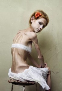 Anoreksikė visame savo klaikume